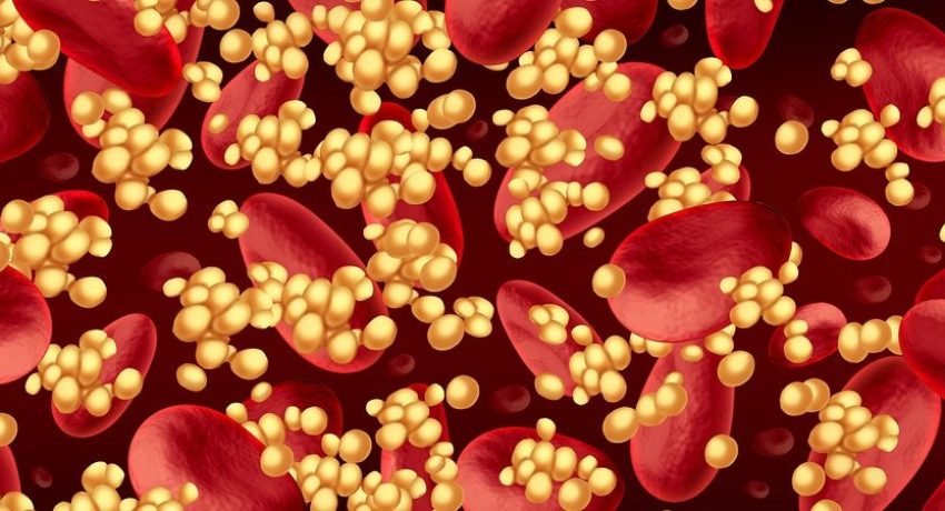 sintomas dislipidemia